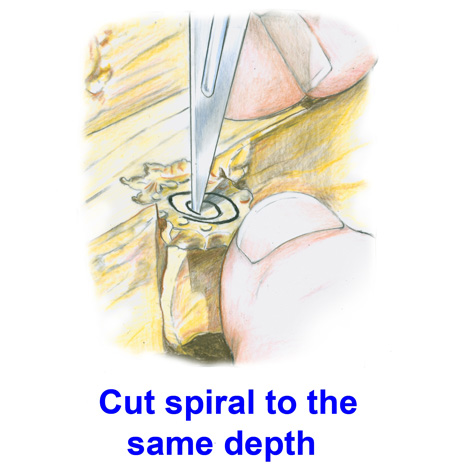 Push a scalpel blade straight down into the rubber and cut spiral to the same depth