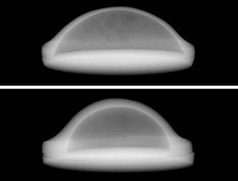 X-ray microradiographs of two mabe samples from Mayotte.