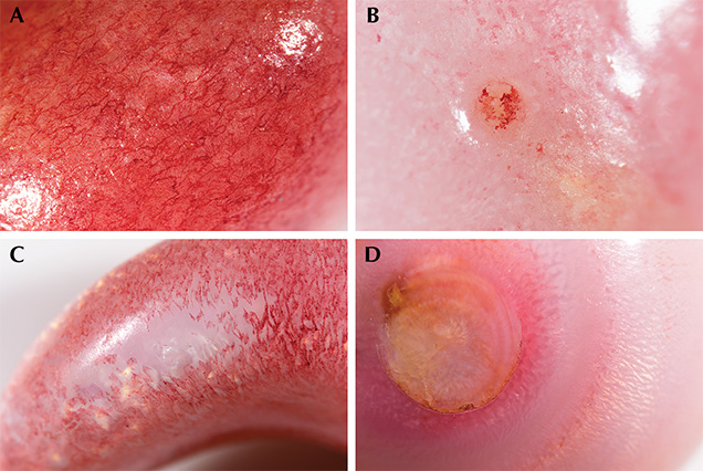 Visible dye concentrations in the four non-nacreous pearls.