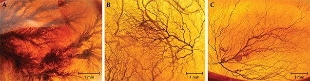 Dendritic inclusions in amber.