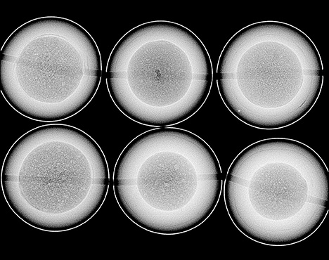 Figure 2. RTX analysis revealed the near-round atypical bead nucleus used to culture each of the pearls.