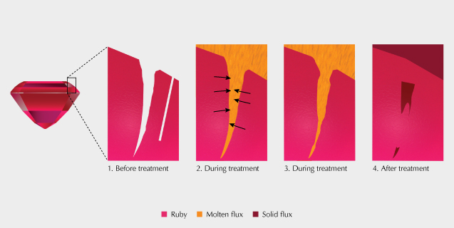 Figure 10. The process of flux healing of fractures during high-temperature heat treatment of ruby in the presence of a fluxing agent. Fractures naturally occurring in a ruby become filled with a molten flux during heating and partially recrystallize corundum. After treatment, some of the molten flux is trapped in these partially healed fractures and solidifies. Illustration by Peter Johnston.