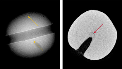 Figure 3. Left: RTX image displaying very fine growth arcs (yellow arrows). Right: μ-CT image showing a center ring with a very fine growth arc inside (red arrow).