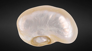 Figure 1. The 169.05 ct filled pearl, viewed from its face (left) and base (right). Note the indented feature on the base through which the filler material was inserted prior to plugging. Photos by Gaurav Bera.