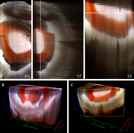 Figure 10. 3D representations of spectra for sample A from figure 9 (left), acquired with 405 nm excitation at room temperature. The spectra associated with each pixel were separated by wavelengths into blue (N3; ZPL = 415.2 nm), green (H3; ZPL = 503.2 nm), and red (plastic deformation–related luminescence at ~700 nm). A: These three images show XY, YZ, and XZ scans of the 3D data cube, indicating three growth events—a central core, another growth rim, and then an outer layer. B and C: Volumetric slices from the full 3D dataset, which can be selectively scanned and freely rotated. Image B is a visualization of the full dataset, while image C shows a diagonal slice through the dataset.