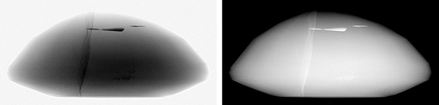 Figure 4. X-ray images of an oval ruby with lead glass–filled fractures, viewed from the girdle. Left: The image collected by digital X-ray imaging. The lead glass is seen as the darker marks. The vertical fracture is narrower and has lower contrast than the horizontal fractures, which are thicker and absorb more X-rays. Right: The same image with inverted grayscale. This contrast is also conventionally used in medical X-ray imaging, where denser, more absorbing structures such as bone are typically white. This is a relic from when X-rays were recorded on photosensitive film as negative images. Many gemological X-ray systems use inverted contrast.