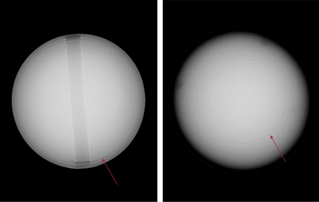 Figure 7. X-ray microradiographs of a 6.85 mm akoya bead cultured pearl and an 11.15 mm South Sea bead cultured pearl. Left: The akoya pearl has a relatively thin nacre, with an approximate thickness of 0.34 mm. A drill hole can also be seen in the middle. The white outline around the edge is due to contrast adjustment to better show the bead demarcation. Right: The South Sea pearl shows a relatively thick nacre, measuring approximately 1.92 mm thick. The demarcations between the shell bead nucleus and nacre in both pearls are transparent to X-rays and indicated by the arrows.