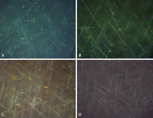 Rutile needles in Wiede’s synthetic star corundum