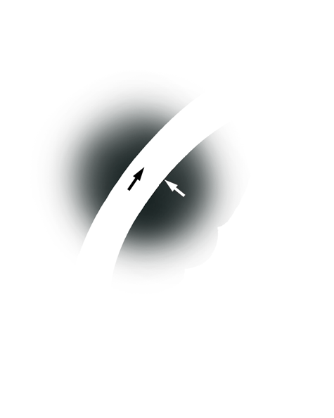 Learn how to evaluate the quality of a platinum ruthenium ring with diamonds in the shank that was sized down using a torch with these helpful illustrations and instructional video